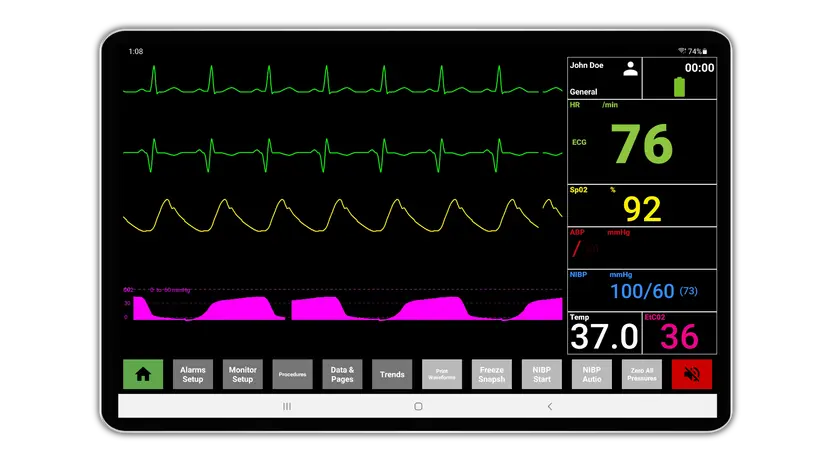 SimVS custom software — tablet clinical simulation with virtual patient monitors